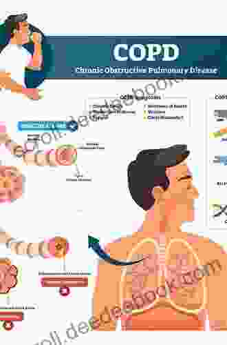 Cough: Pathophysiology Diagnosis And Treatment