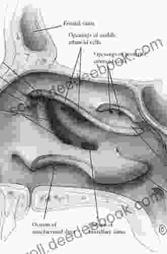 Endoscopic Anatomy Of The Paranasal Sinuses