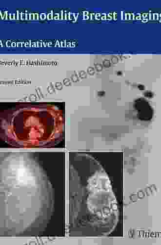 Multimodality Breast Imaging: A Correlative Atlas