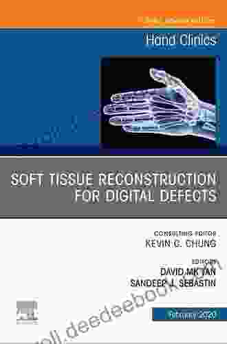 Soft Tissue Reconstruction For Digital Defects An Issue Of Hand Clinics E (The Clinics: Orthopedics 36)